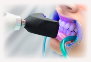 Стоматология: как отбеливают зубы